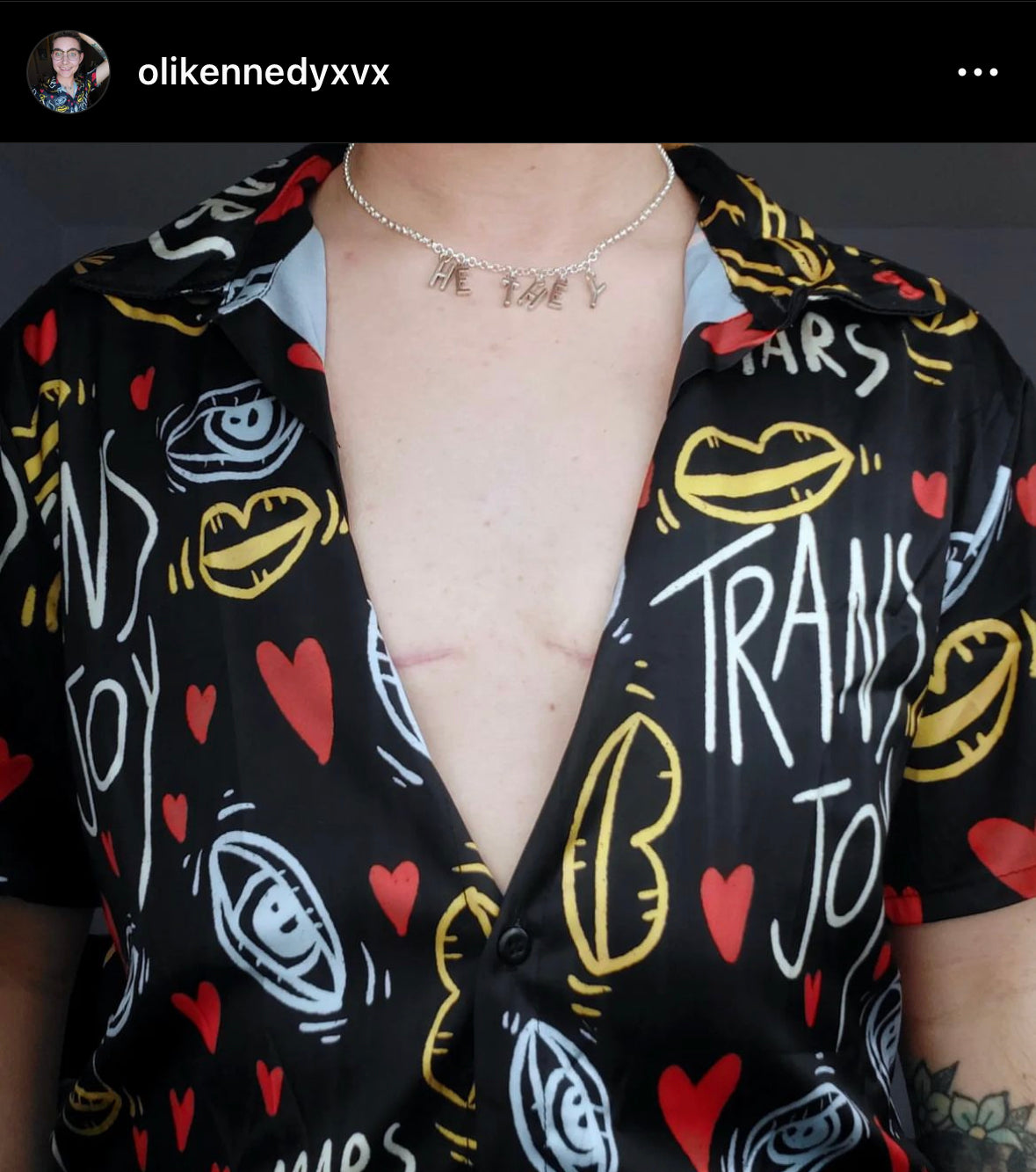 Trans Joy Printed Button Up