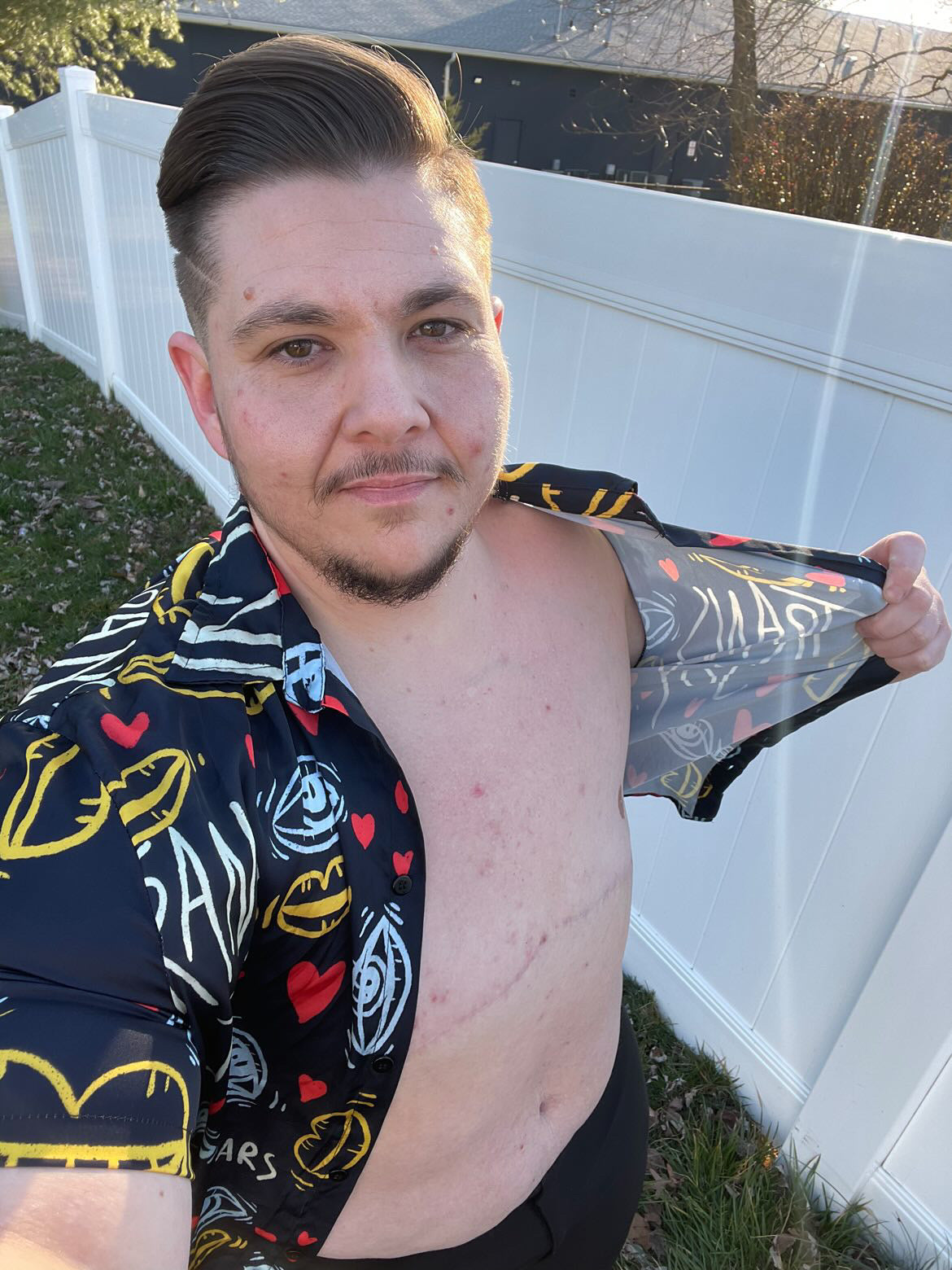 Trans Joy Printed Button Up