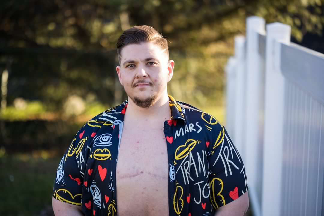 Trans Joy Printed Button Up